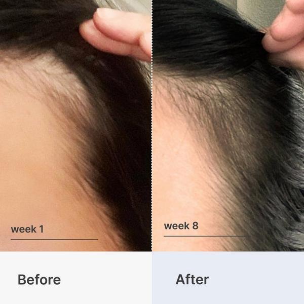 Better Not Younger Superpower Fortifying Hair & Scalp Serum #4
