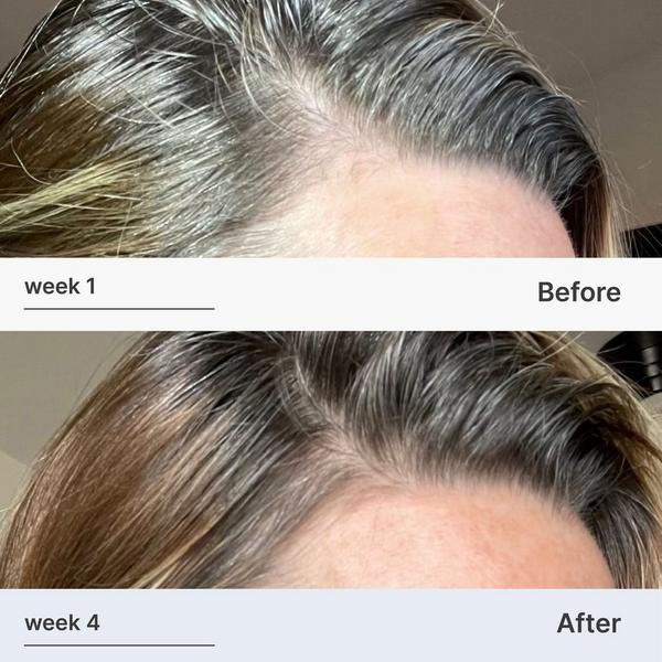 Better Not Younger Superpower Fortifying Hair & Scalp Serum #6